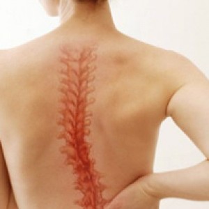 uprazhneniya-dlya-spinyi-pri-zabolevanii-skoliozom-ili-ego-profilaktike-600x400